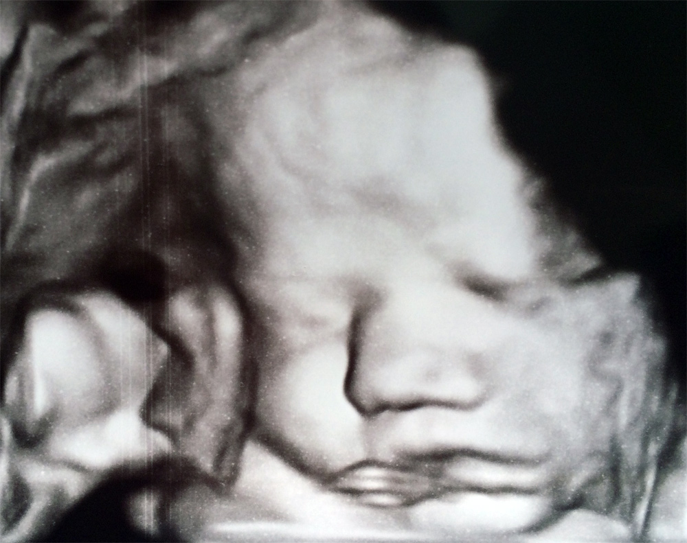 Ultrasound Baby at 40 weeks